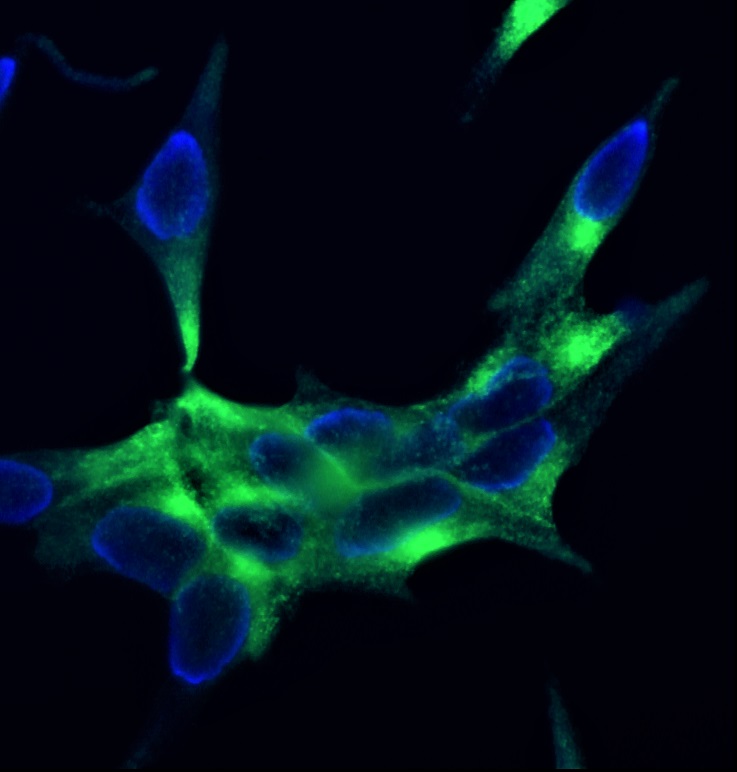 Figure 3. Indirect immunofluorescence staining of PSMA in the prostate cancer cell line LNCaP cells using MUB1510P, clone 107-1A4 (diluted 1:500). Note the membranous localization of PSMA. Nuclear DNA staining with DAPI.